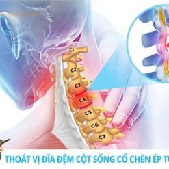 ĐAI KÉO GIÃN CỘT SỐNG CỔ GBM-006 - Ảnh 11